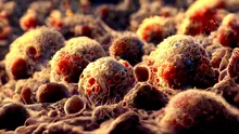 Cercetătorii au aflat cum celulele cancerului de colon își schimbă identitatea pentru a se răspândi