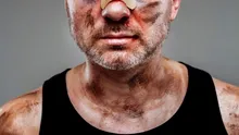 BANCUL ZILEI. Bulă ajunge la Urgențe după ce e bătut zdravăn de Bubulina