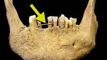 Schelet medieval descoperit cu ceva ciudat între dinți