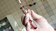 Cercetătorii francezi identifică un nou tip de sânge – Gwada negativ