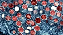 Pentru prima dată în România, a fost confirmată prezenţa virusului POX