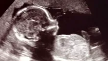 În ce moment devine conștient un fetus?